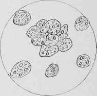 Cells of Liver of Horse affected with Haemo globinuria.