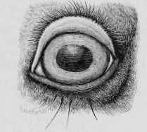 Ectropium or Everted Eyelid (Front View).