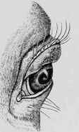 Ectropium or Everted Eyelid.