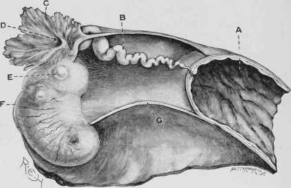 Fallopian Tube connecting the Uterus with the Ovary.