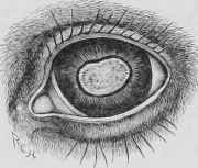 Fig. 256,   Cataract Complete.