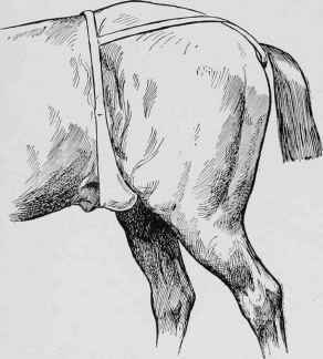 Orchitis   Testicle Suspended.