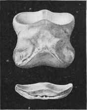 Os Coronae and Os Naviculare (Anterior Aspect).