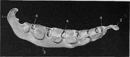 Sternum Cariniform Cartilage.