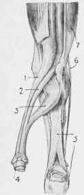 The Check Ligament.
