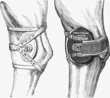 Compresses for Thoroughpin.