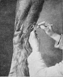 Neurectomy of the Ulnar Nerve.