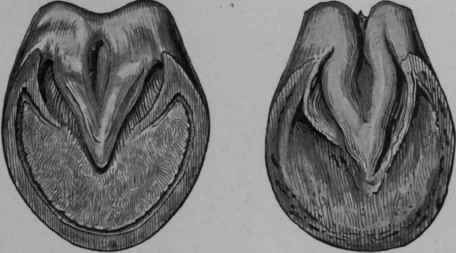 Normal Hoof and Contracted Hoof.