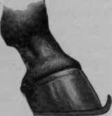 Shoe to prevent Contraction of the Back Sinews of the Leg after treatment for Sprain.