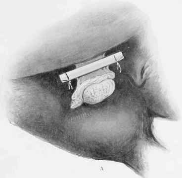 Standing Operation 700106