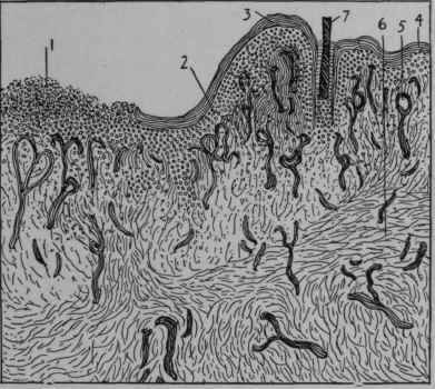 Wound Healing by Granulation.