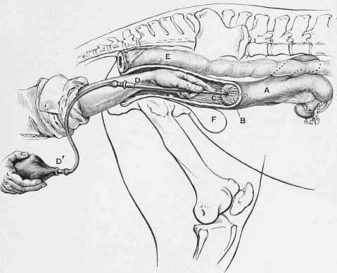 Artificial Insemination: Passing the Inseminator into the Uterus.