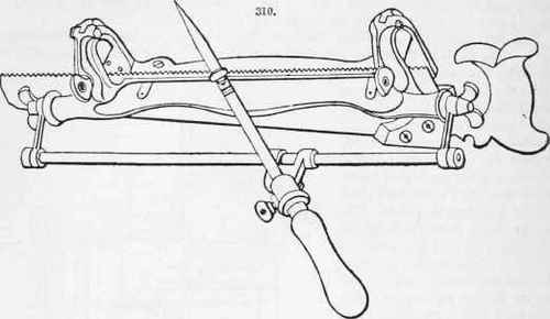 Filing And Setting Saws Part 3 313