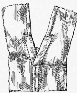 XI-The-Gusset-36