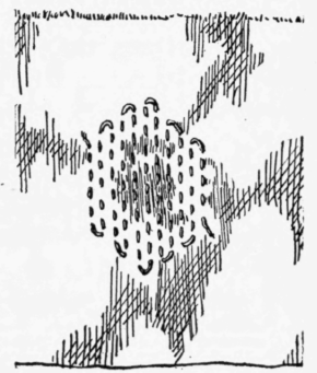 XIX-Darning-62