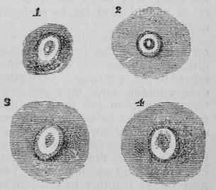 Mode Of Vaccinating 156