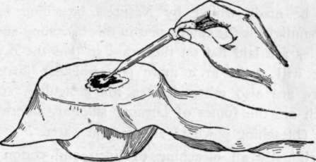 Fig. 10. Removing Iron Rust Stain