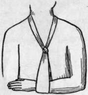 Slings For Lower And Upper Arms