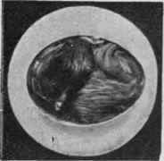 Chicken ready to come out