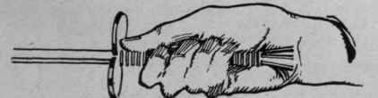 Fig. 2. Position of fingers making the lunge