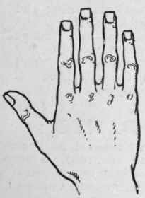 Fig. 2.   The Square Hand denotes