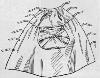 Fig. 3 Barracoat open, showing the arrangement of tabs and pins