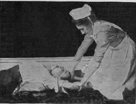Fig. 4. The Sylvester method of restoring the apparently drowned by artificial respiration