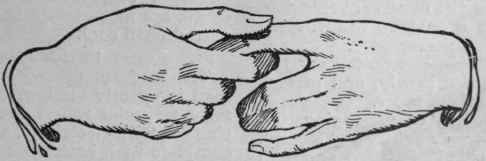 Fig. I. The fingers should be taken singly between the thumb and index finger, and stroked from finger tip to palm, as if putting on a glove