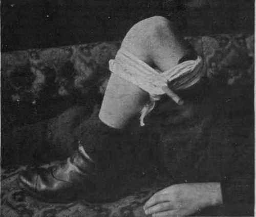 From the face below the eyes: Compress the artery that passes over the edge of lower jaw, apply a hard pad, as above.