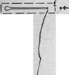 Diagram 3. Stick the needle into the coat at a short distance from the end of the slit. The arrow head indicates the knot of twisted thread. Drop the needle and hold thread under the left thumb