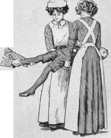 Fig. 2. For lifting a patient with a broken leg, a third person.