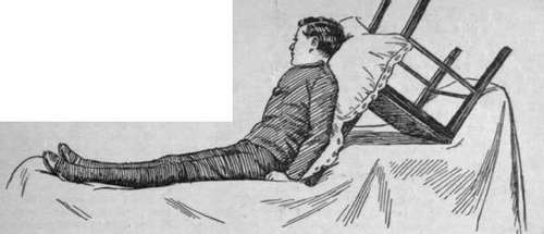 Fig. 5. A useful emergency bed rest can be made with an ordinary chair, placed so as to afford a slope, and padded with pillows tied to the chair, which must itself be secured to the bedstead of the bed clothes off injured limbs can be made from