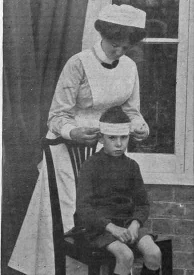 Bandaging the head. 1st position. The nurse stands behind the patient with the larger roll in the left hand the smaller in the right