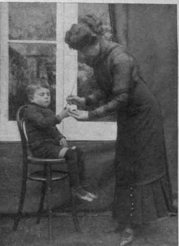 Painting unbroken chilblains with tincture of iodine gives much relief, but this tincture must never be applied to broken chilblains