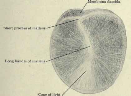 Fig. 102. Outer surface of the tympanic membrane of the left ear, is called Shrapnell' s membrane or membrana flaccida. As it possesses no fibrous • layer it is weaker than the membrane elsewhere and consequently is a favorite spot for pus to perforate in order to find exit from the middle ear.