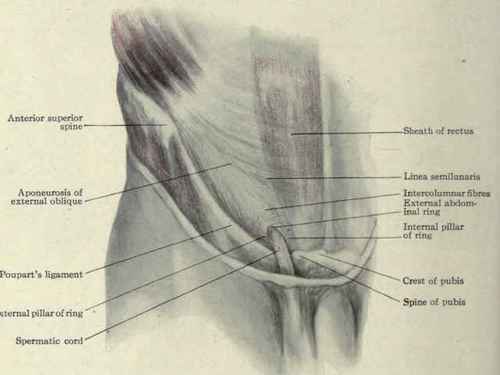 Fig. 395. Parts concerned in inguinal hernia; the external abdominal ring.