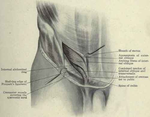 Fig. 396. Parts concerned in inguinal hernia; the inguinal canal exposed.