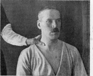 Fig. 100. Throat Effleurage (Weiss Method).