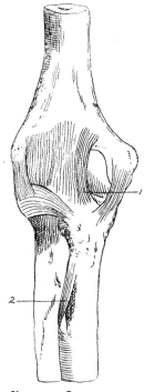 Fig. 11. Ligaments of Elbow.