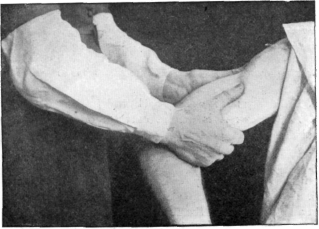 Fig. 48. Pétrissage with Palms