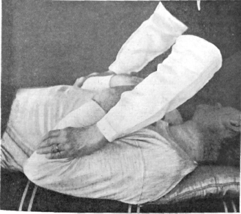 Fig. 78. Artificial Respiration.