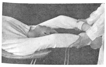 Fig. 79. Artificial Respiration.