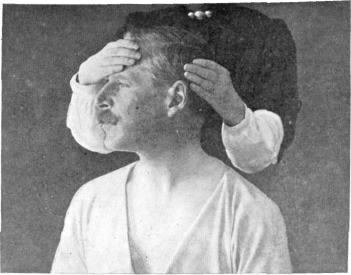 Fig. 97. Rotation of the Head.