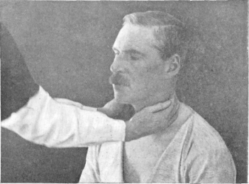 Fig. 98. Throat Effleurage (Gerst Method). Beginning of the
Movement.