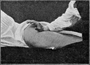 Fig. 11