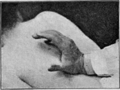 Fig. 12