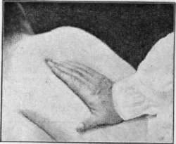 Fig. 13