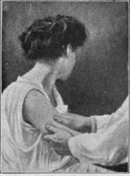 Fig. 16