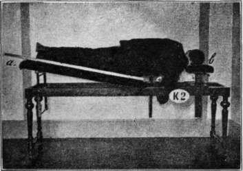 Fig. 162