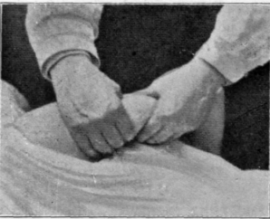 Fig. 17